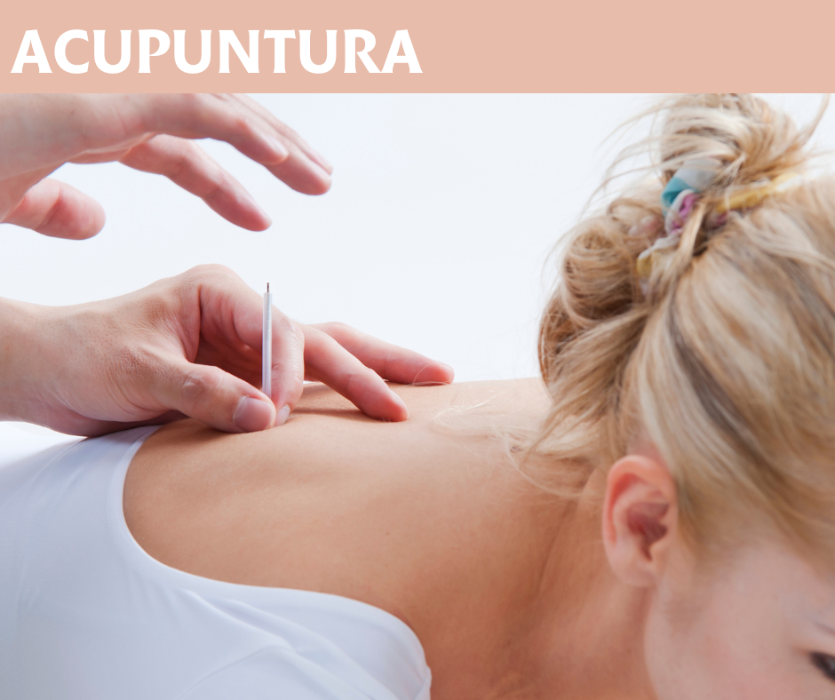 Acupuntura